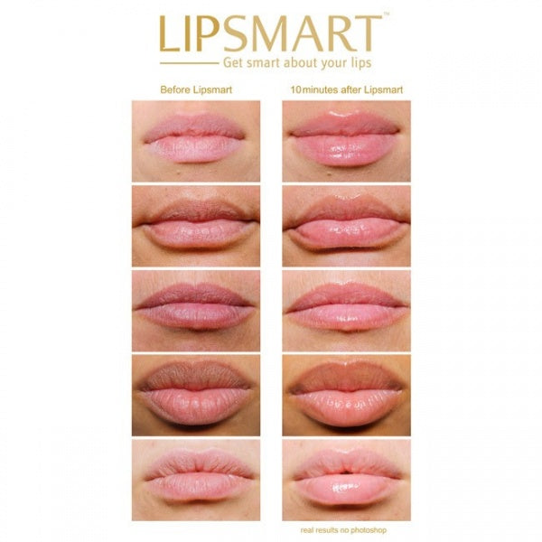 Lipsmart 10ml