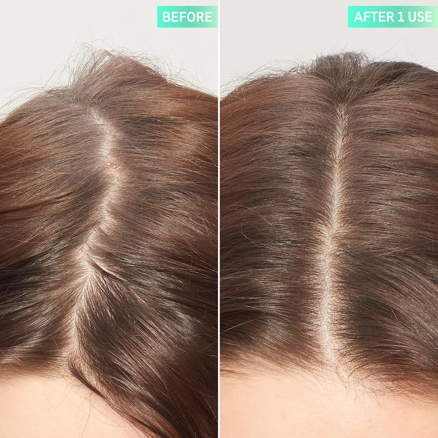 The Inkey List Glycolic Acid Exfoliating Scalp Scrub 150ml