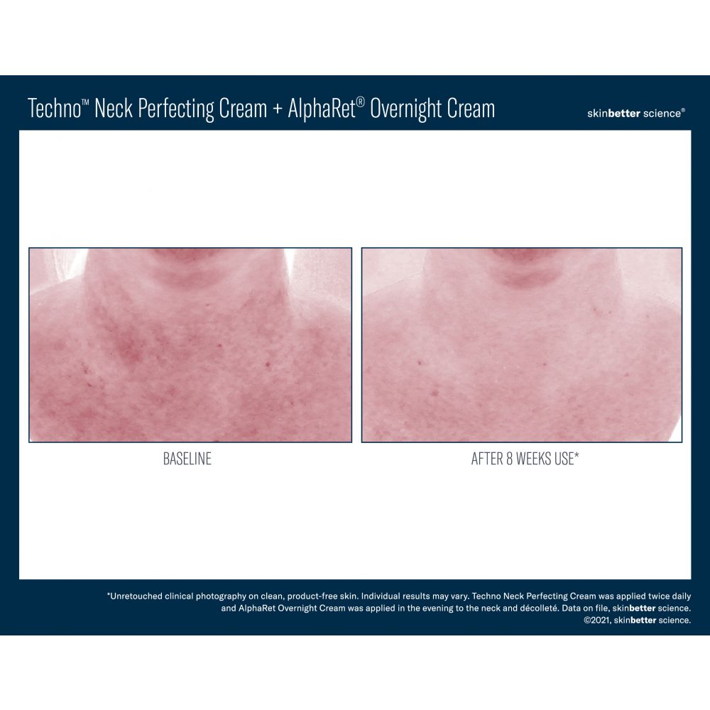 Skinbetter Science Techno Neck Perfecting Cream 50ml
