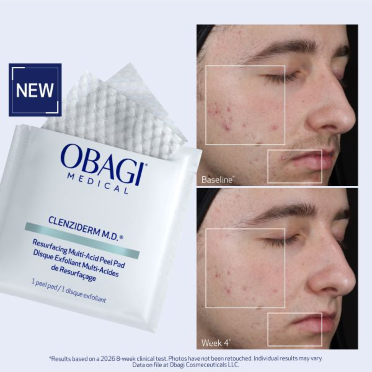Obagi CLENZIDERM M.D. Resurface Multi Acid Peel Pads 30stk