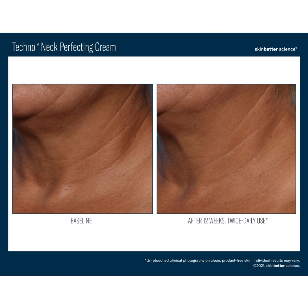 Skinbetter Science Techno Neck Perfecting Cream 50ml