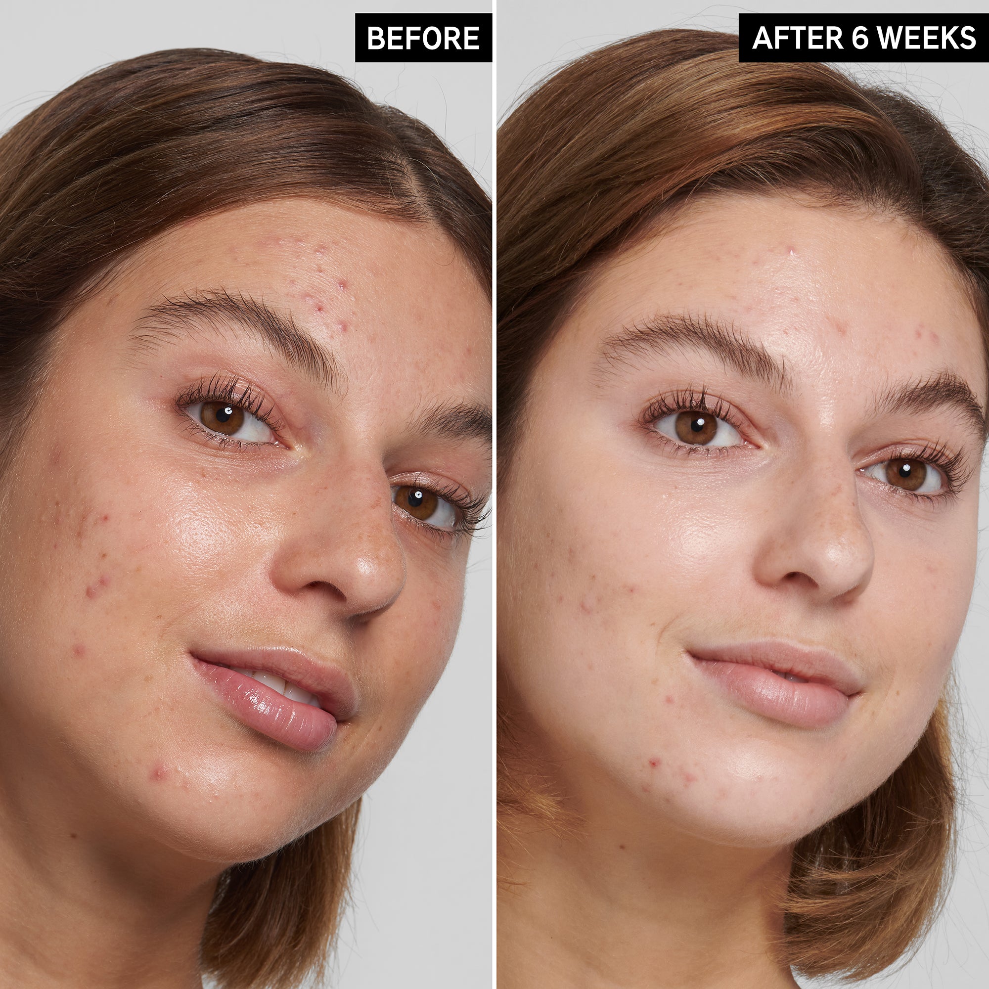 The Inkey List Salicylic Acid Cleanser 150ml