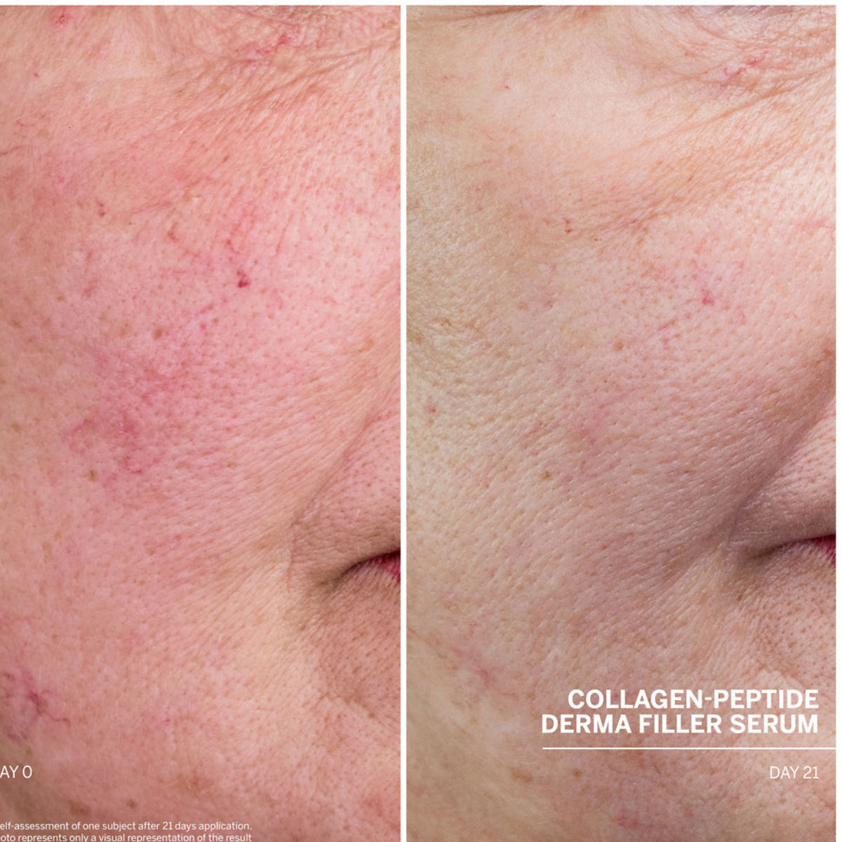 Babor Dr. Babor Collagen-Peptide Derma Filler Serum 30ml