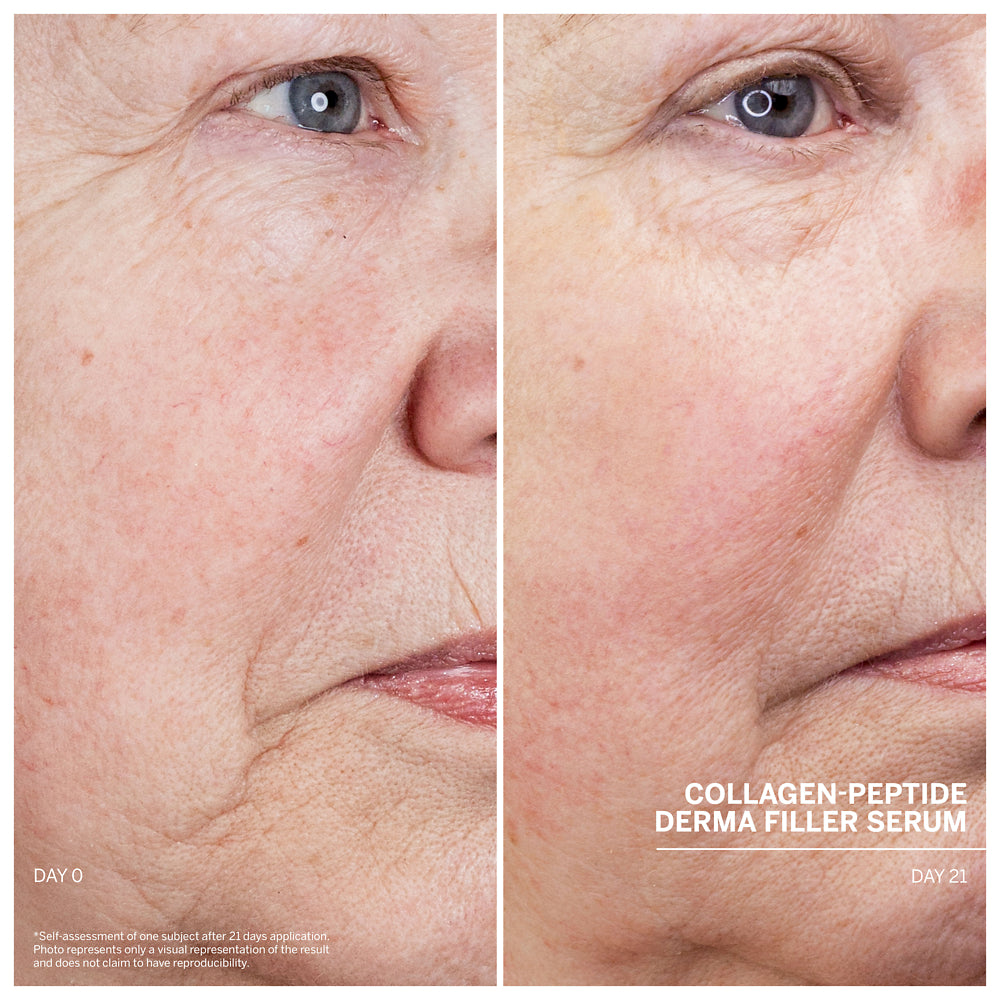 Babor Dr. Babor Collagen-Peptide Derma Filler Serum 30ml