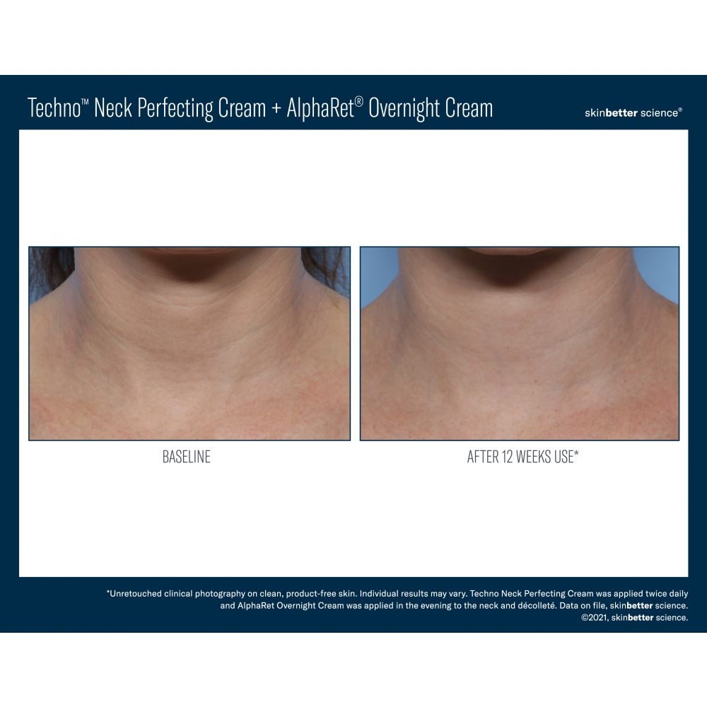 Skinbetter Science Techno Neck Perfecting Cream 50ml